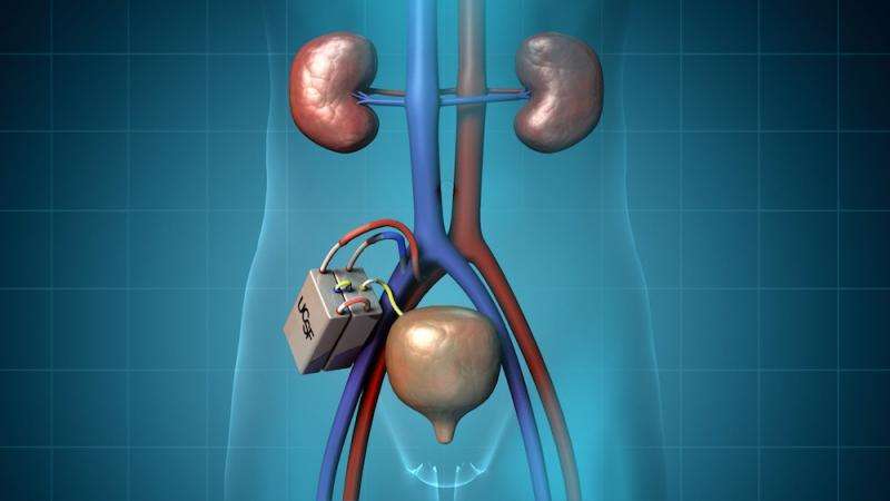 artificial heart valve
